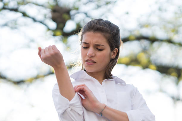 istock Itch caused by allergy to tree pollen 670825268