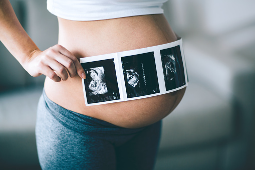 Hermosa mujer embarazada sosteniendo ultrasonido en el vientre photo