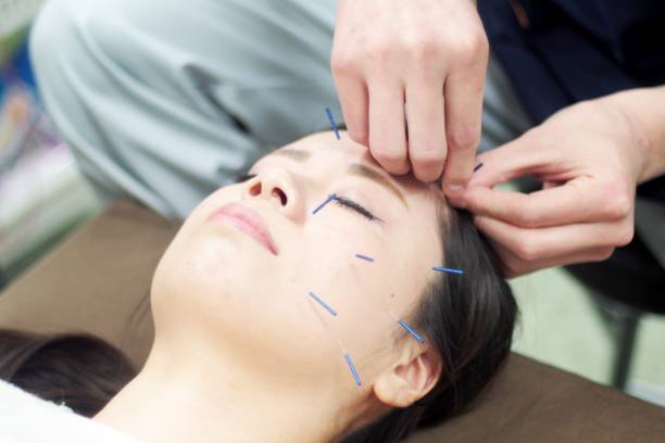 istock Woman receiving acupuncture on face 671207714