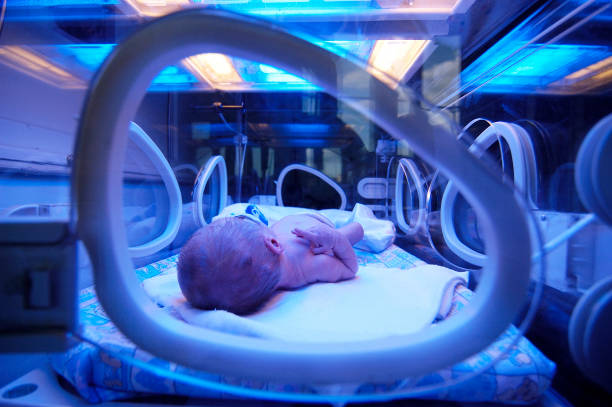 bebé niño recién nacido tiene un tratamiento para la ictericia bajo luz ultravioleta en incubadora. - premature fotografías e imágenes de stock