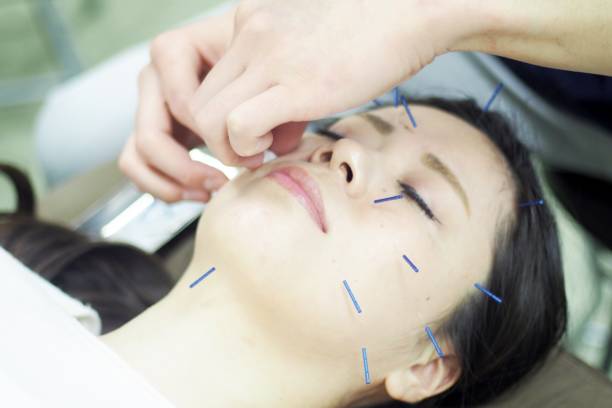 istock Disinfect women's face for acupuncture 671557312