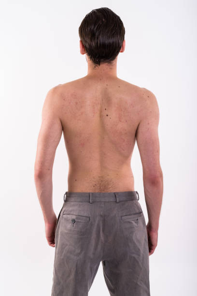 흰색 배경 shirtless 서 젊은 남자의 다시 보기의 스튜디오 샷 - acne back rear view men 뉴스 사진 이미지