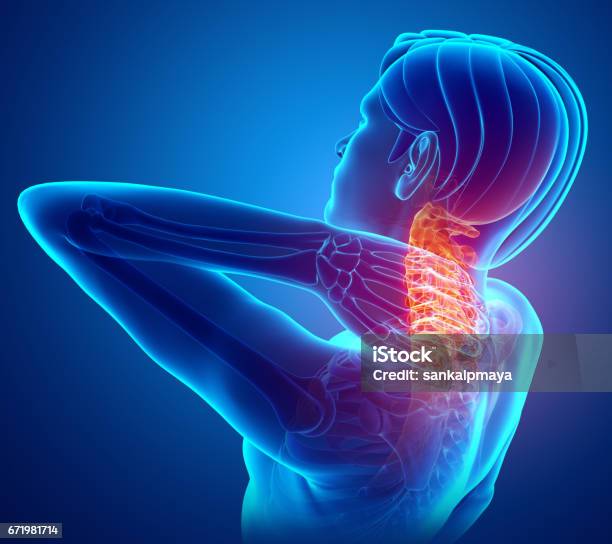 Male Feeling The Neck Pain Stock Illustration - Download Image Now - Neckache, Backache, Pain