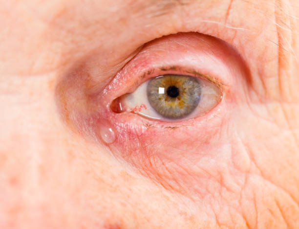 istock Elderly woman eye 672015414