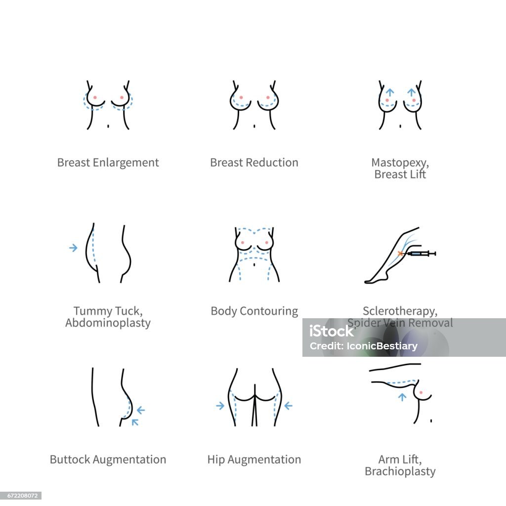 Body plastic surgery and aesthetic medicine icons Body plastic surgery, aesthetic medicine, cosmetic procedure symbols. Thin line art icons with flat colorful design elements. Woman before and after view. Linear style illustrations isolated on white. Breast stock vector