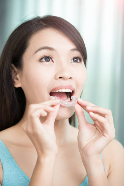 istock woman with invisible braces 672268740