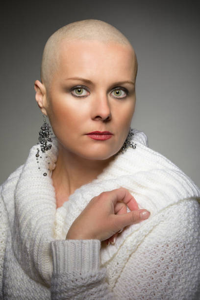beautiful middle age woman cancer patient without hair - shaved head imagens e fotografias de stock