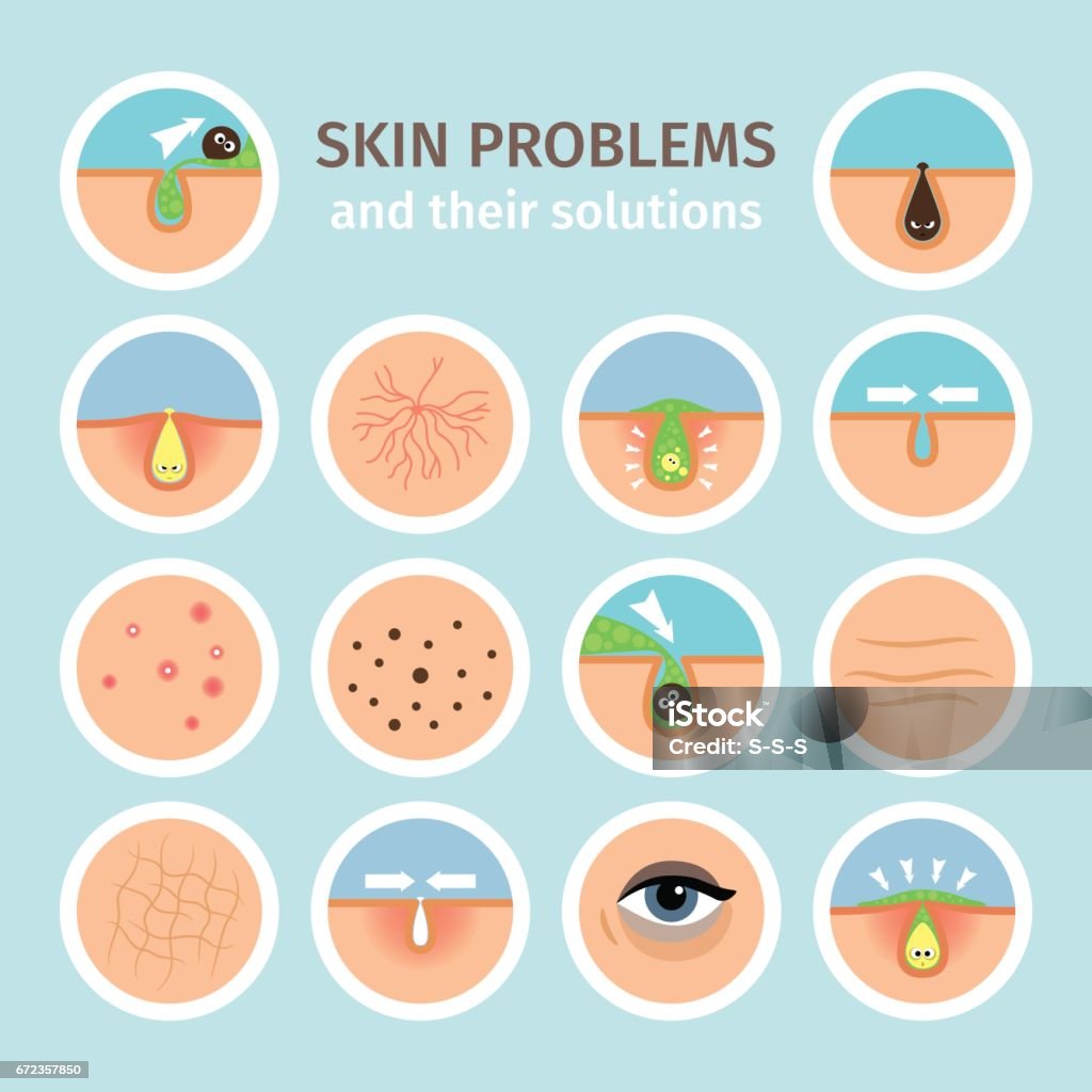 Facial treatments and problem correction Skin problems. Facial treatments, face washing and problem correction vector illustration Pore stock vector