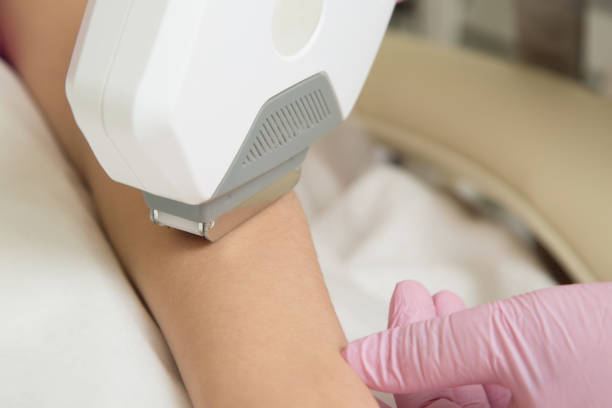 istock Epilation in the beauty salon. 672450160