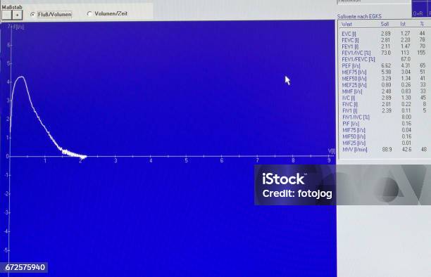 Spirogram From Lung Function Test Stock Photo - Download Image Now ...