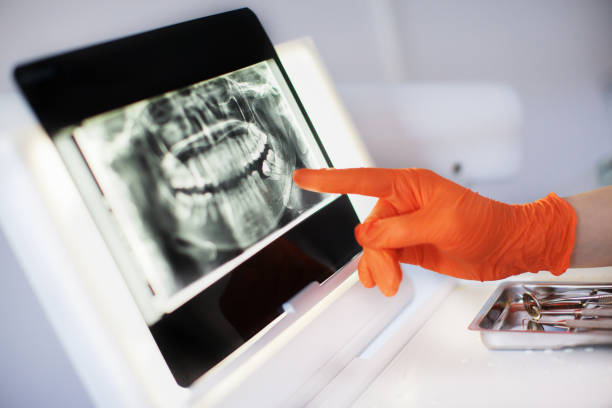 dentiste les outils médicaux - dental assistent photos et images de collection