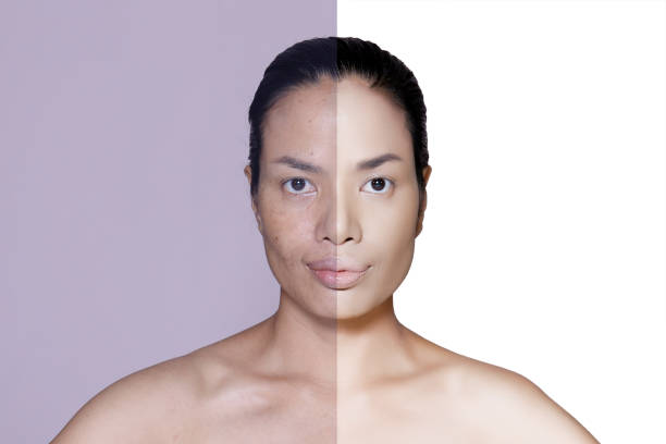 istock Woman face before and after retouch 672879246