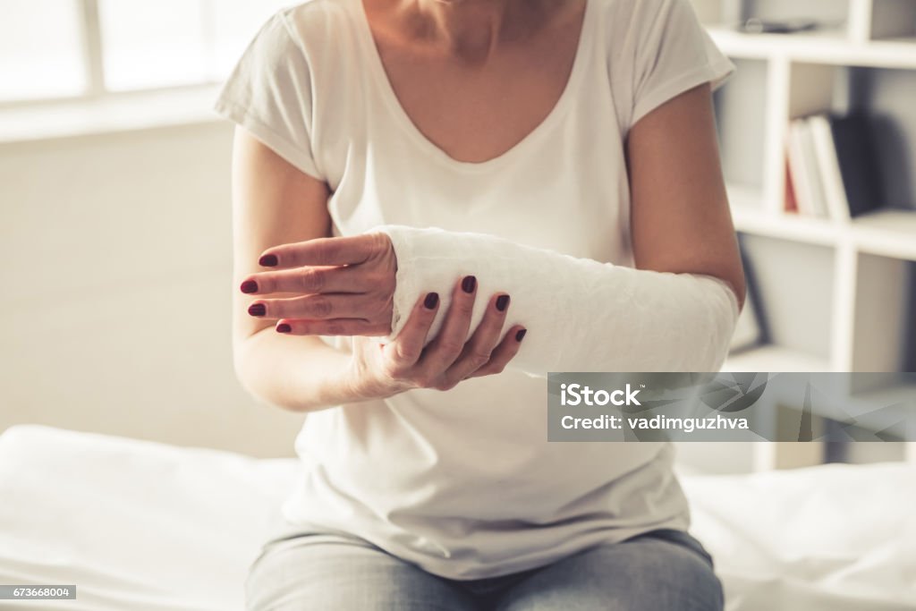 Femme avec le traumatisme - Photo de Fracture libre de droits