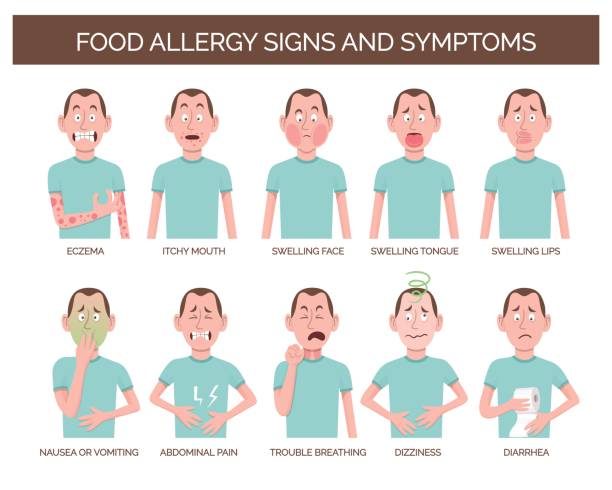 tanda dan gejala alergi makanan - food allergies ilustrasi stok