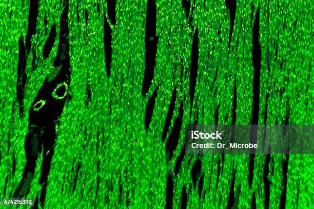 Músculo Cardíaco Micrográfo Ligero Foto de stock y más banco de imágenes de Afección médica - Afección médica, Anatomía, Animal microscópico