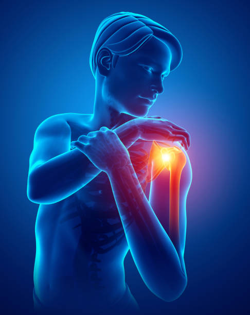 istock Male Feeling the Shoulder Pain 674244412