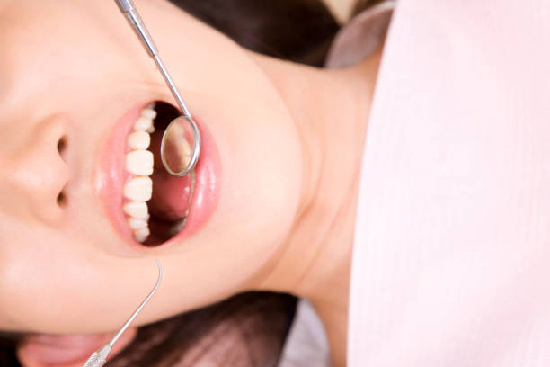 istock Women who undergo dental mouth 674278612