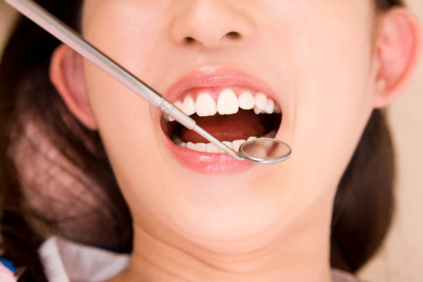 istock Women who undergo dental mouth 674278624