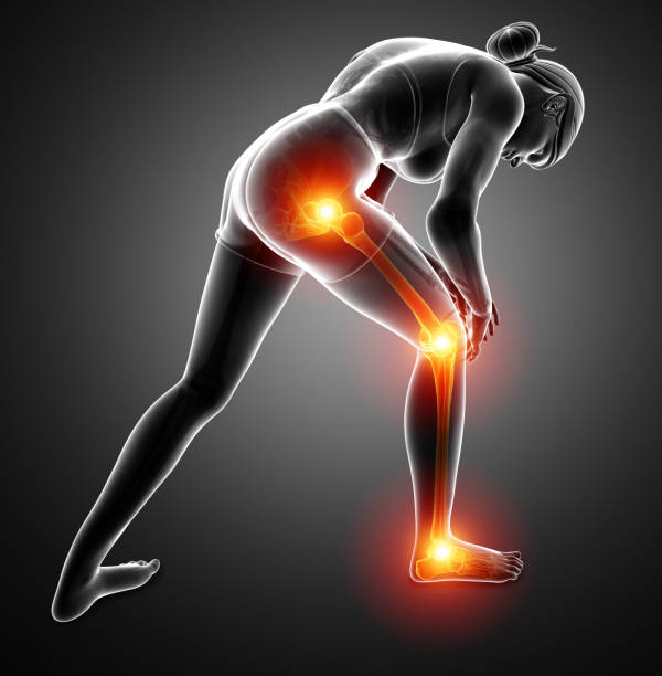 Female Leg joint pain vector art illustration