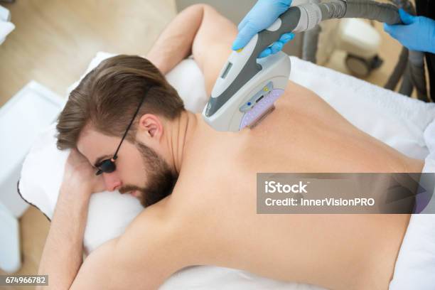美容師与える男性レーザー脱毛 - 脱毛のストックフォトや画像を多数ご用意 - 脱毛, レーザー光, 医療用レーザー装置