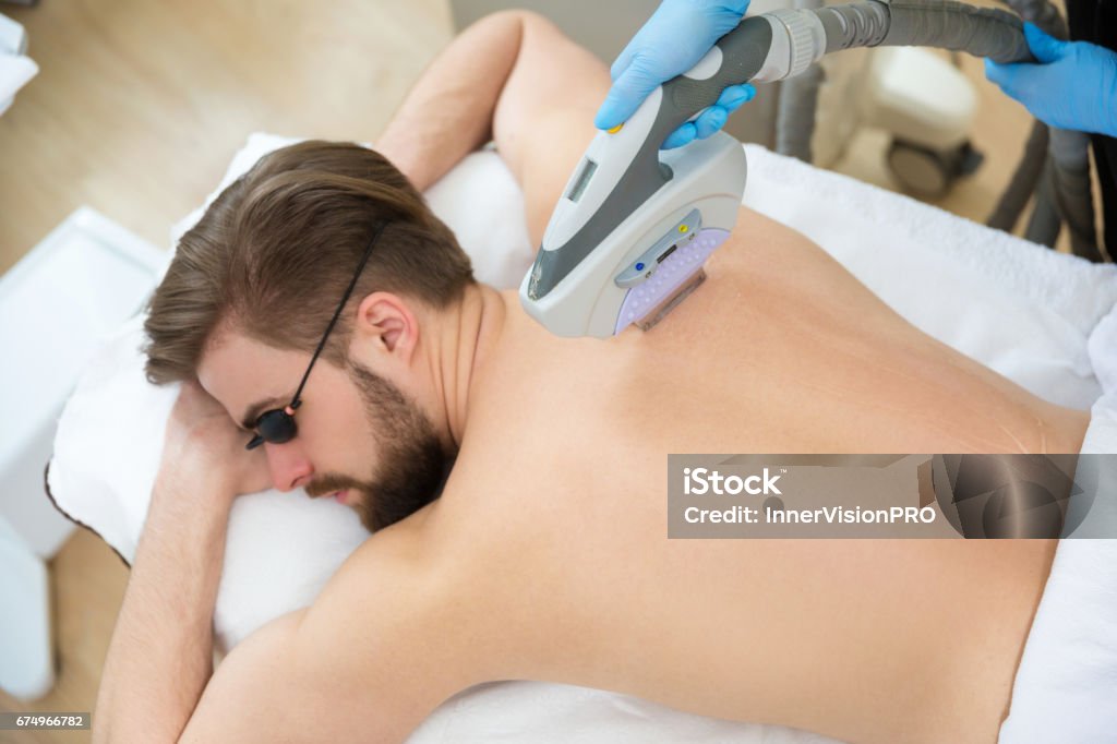 Beautician giving men laser epilation Men lying at beautician's during laser back hair removal therapy Hair Removal Stock Photo
