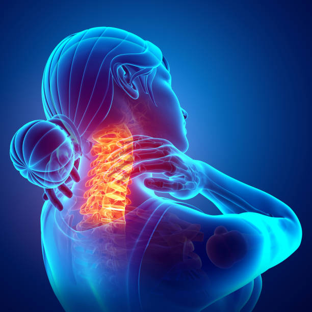 Women Feeling the Neck Pain stock photo