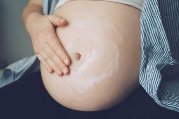 Femme enceinte mettant la crème sur son ventre pour éviter des vergetures - Photo