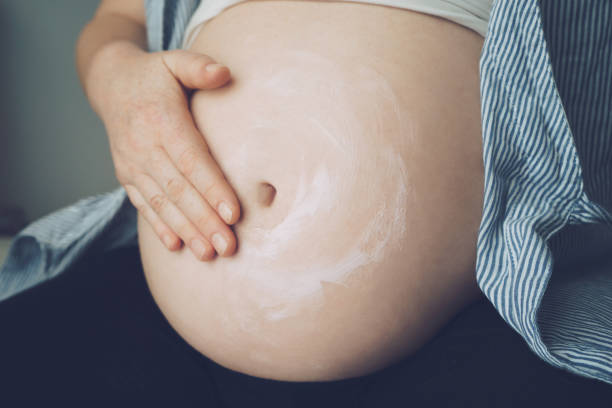 스트레치 마크를 피하기 위해 그녀의 뱃속에 크림을 퍼 팅 임신 한 여자 스톡 사진