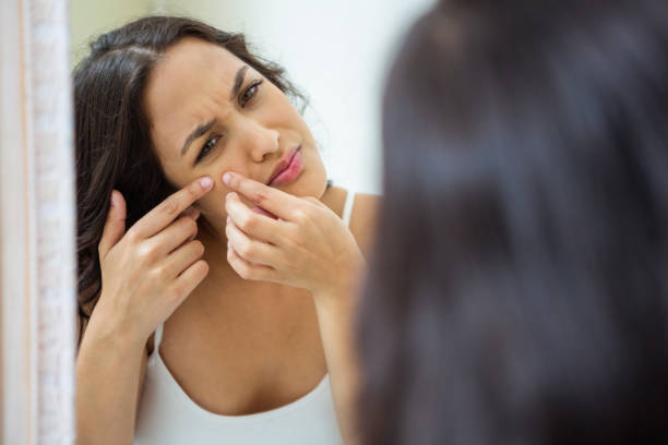 istock Woman popping her pimple 675445496