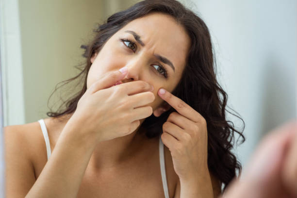istock Woman popping her pimple 675445532