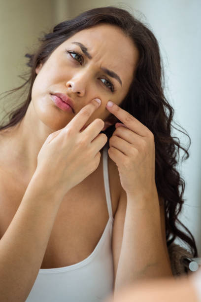 istock Woman popping her pimple 675445582