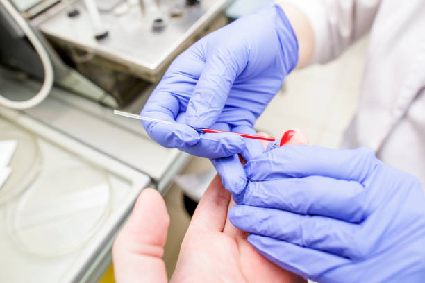 lekarz pobiera badanie krwi pacjenta z palca - laboratory blood laboratory equipment medical sample zdjęcia i obrazy z banku zdjęć