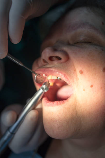 istock The dentist works with the client in the clinic 675713092