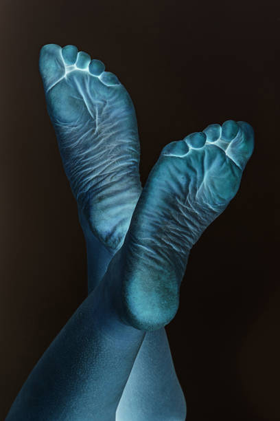 istock dehydrated skin female heels 675938188