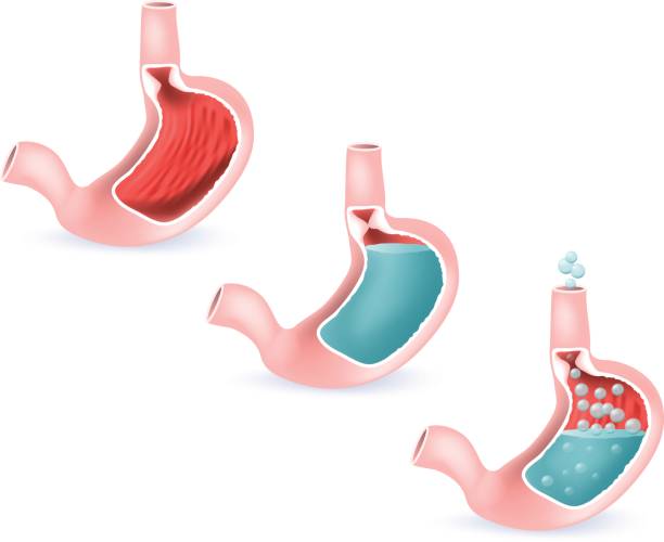 istock Stomach and digestive. Full and empty stomach, and gastroesophageal reflux disease. 675987584