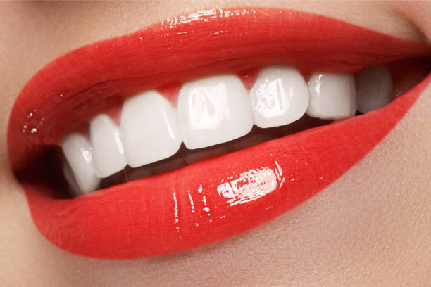 istock Woman teeth before and after whitening 677169340