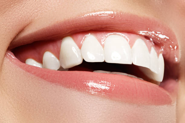 istock Perfect smile before and after bleaching. Dental care 677169368