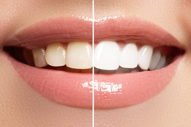 istock Macro happy woman's smile with healthy white teeth, bright pink lips make-up 677169642