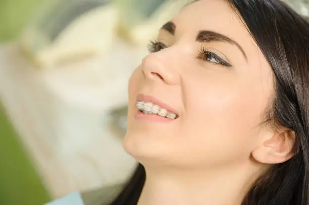 Photo of Woman with ceramic braces on teeth at the dental office