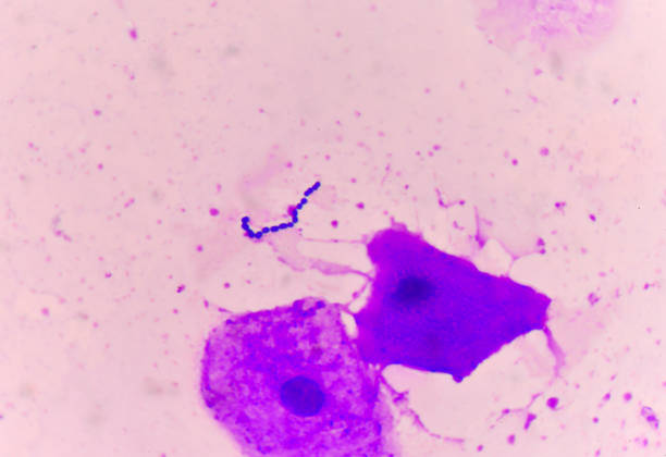 istock Yeast cells with epithelial tissue in Gram stain method. 677884298