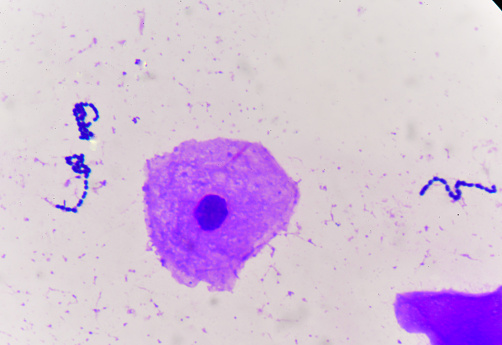 Yeast cells with epithelial tissue in Gram stain method.