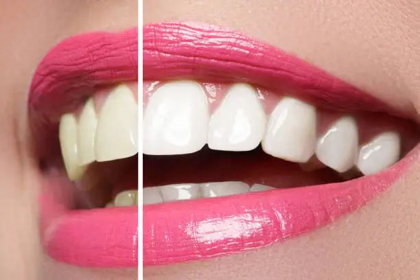 Macro happy woman's smile with healthy white teeth, bright pink lips make-up. Stomatology and beauty care. Woman smiling with great teeth. Cheerful female smile with fresh clear skin