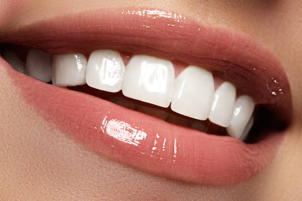 istock Perfect smile before and after bleaching. Dental care 678507646