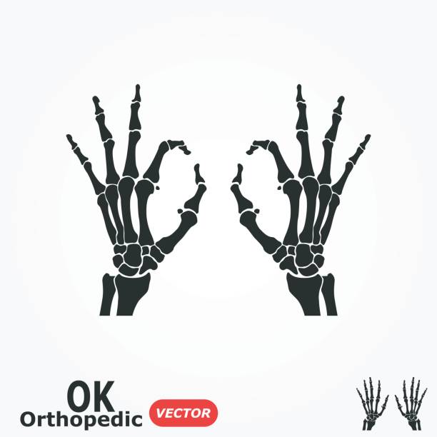 ok ortopedyczne ( x-ray ludzkiej ręki z ok znak) - metacarpal stock illustrations