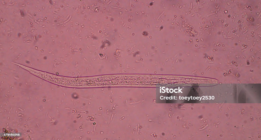 Strongyloides stercoralis (threadworm) in stool, analyzer by microscope Strongyloides Stercoralis Stock Photo