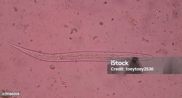 Strongyloides Stercoralis In Stool Analyzer By Microscope Stock Photo - Download Image Now