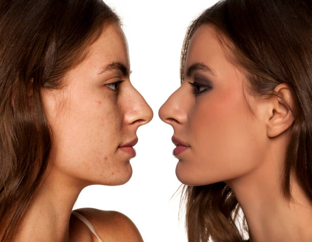 istock comparative portrait of the same woman, with and without makeup 679734212