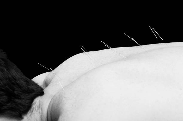 istock Chinese medicine doing acupuncture to man patient in silhouette studio over black. 679826252