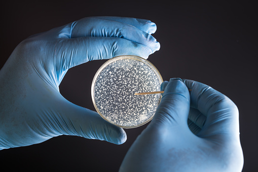 researcher hand with petri dish with bacterial colony