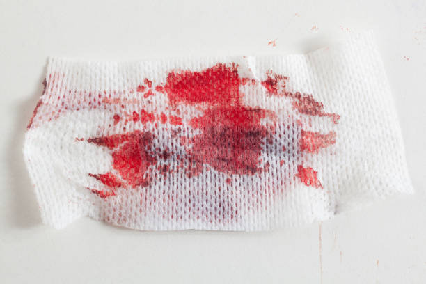 gasa con sangre - gauze fotografías e imágenes de stock